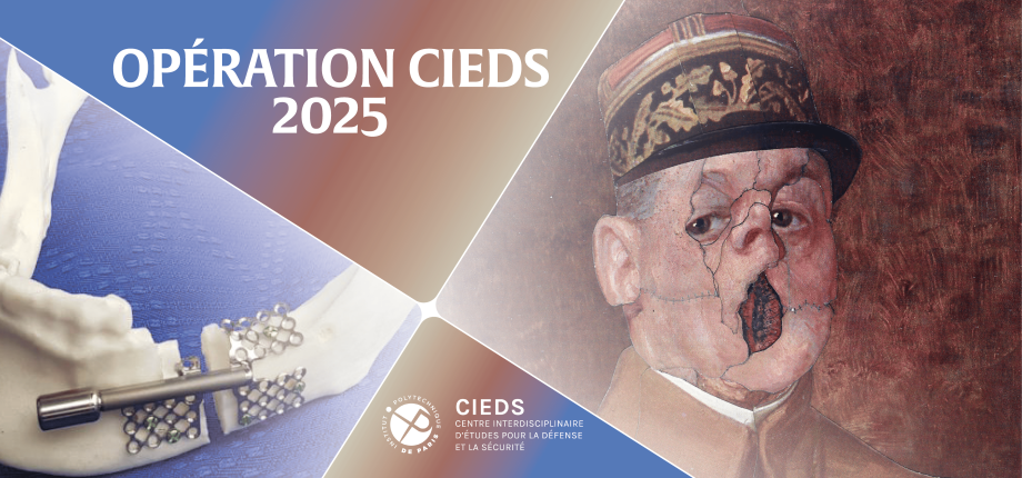 Operation CIEDS 2025: A Groundbreaking Technology for Reconstructing the Jaws of War-Wounded