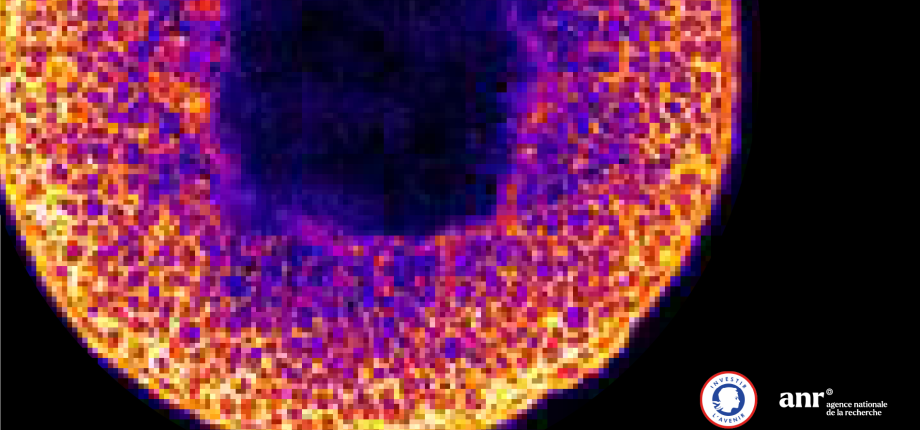 Morphoscope - Photonic Microscopy 
