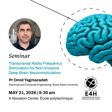 E4H Seminar : Pr Omid Yaghmazadeh